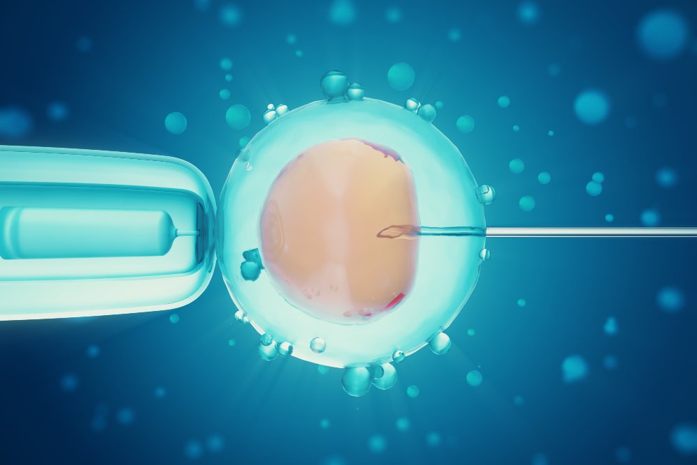 הפריה חוץ גופית (IVF)